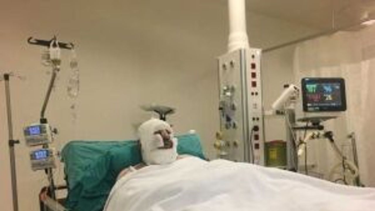 Yangında ölümden döndü, Eskişehir'de tedavi altına alındı